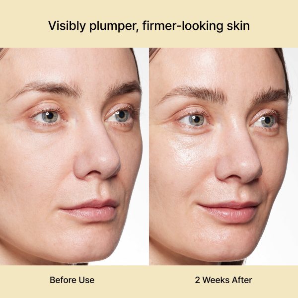 Before and after use of the Rejuran Dual Effect Ampoule