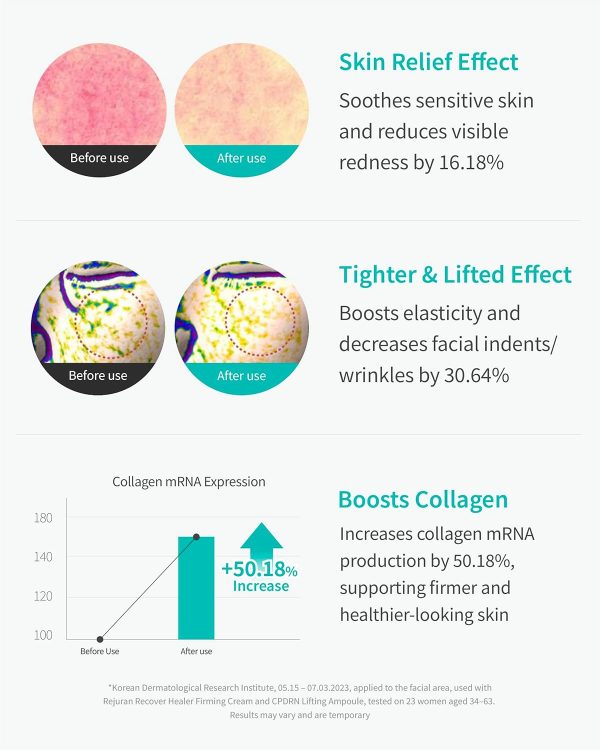Rejuran Lifting Ampoule science behind