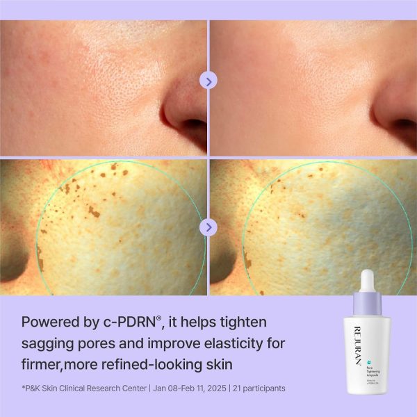 Before and after Pore Tightening Ampoule