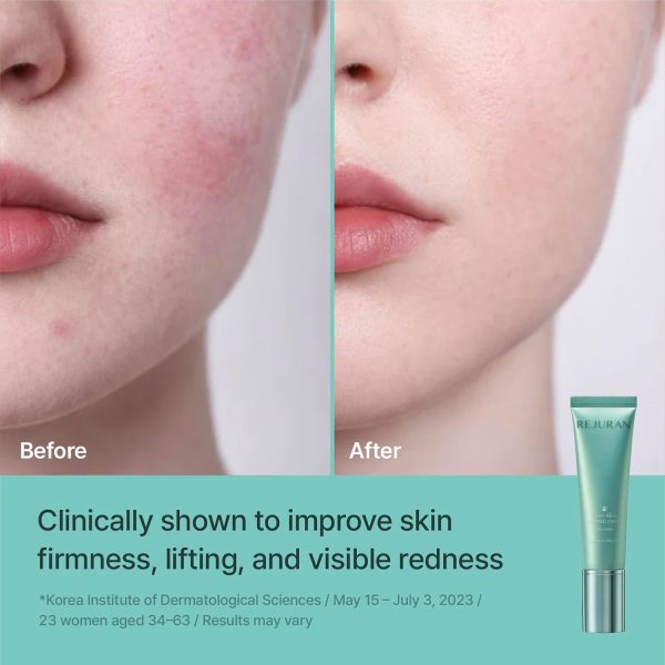 before and after Recover Firming Cream
