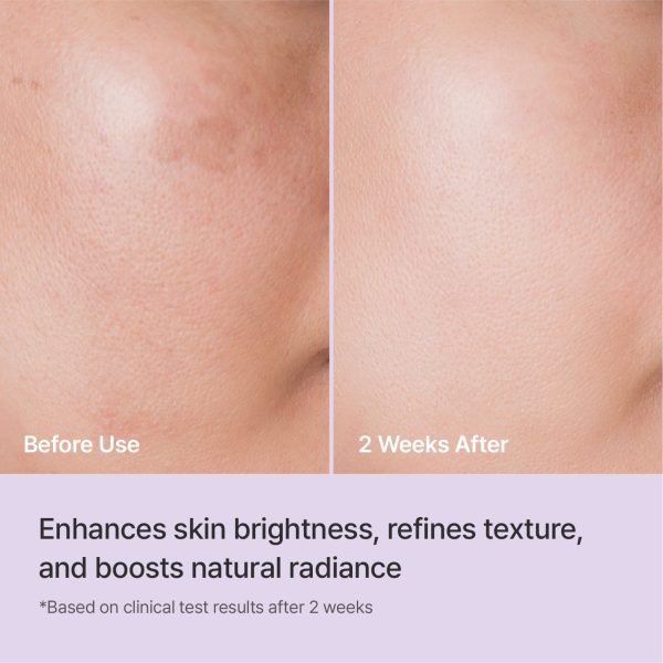 before and after Triple Radiance Ampoule