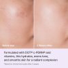 before and after Complete anti-aging care Triple Radiance Cream