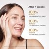 After 4 weeks of using the Rejuran Dual Effect Ampoule